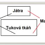 Metabolický syndrom (MS)